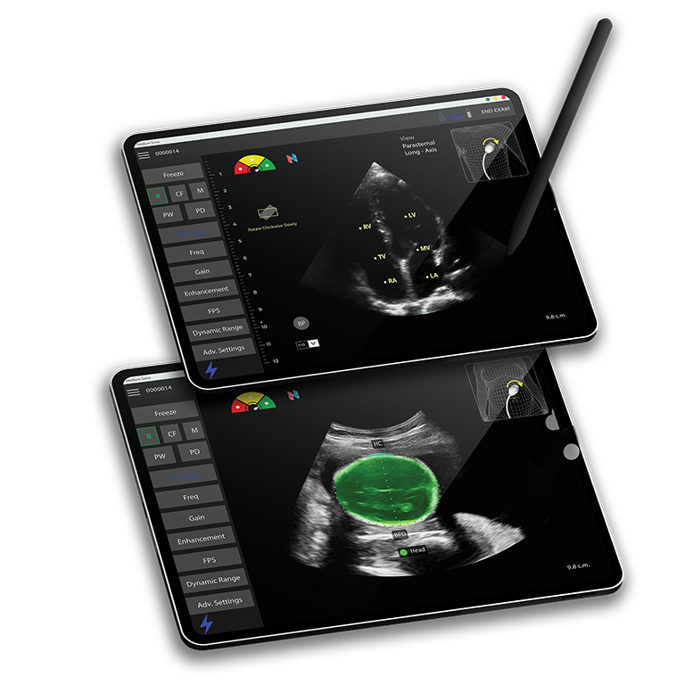 HeartFocus medical devices showing cardiac imaging