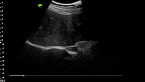 Uncompromising Image Quality_Liver